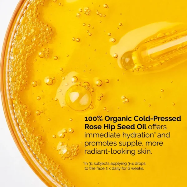 Anti-Pigmentvlekken Creme>The Ordinary De Gewone Hydratatie 100% Biologische Koudgeperste Rozenbottelzaadolie